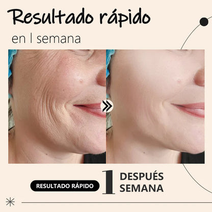 (Yan's) Nueva mascarilla reafirmante de colágeno PuriMe Coreano con masajeador facial iónico